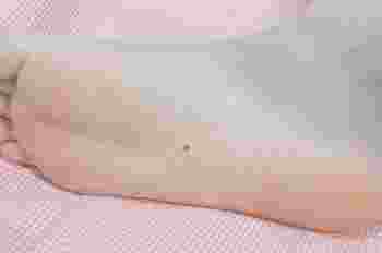 女孩左脚底下最好的痣_容易成为富婆的痣相