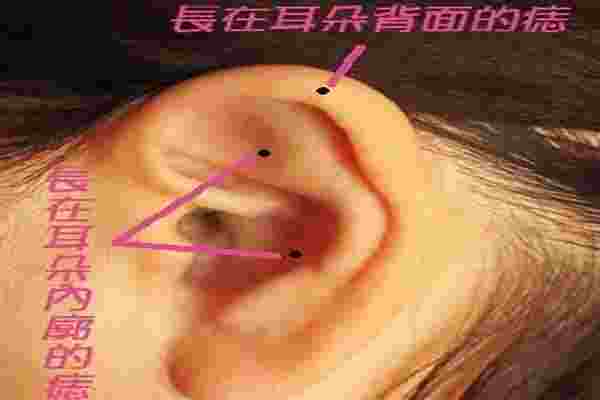 耳屏耳朵里有痣代表什么_耳屏有痣的女人的命运