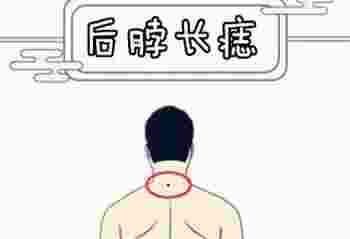 男人横财痣长哪里_男人身上哪里的痣是横财痣