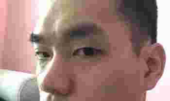 印堂凹陷有什么不好_男人印堂凹陷有什么不好