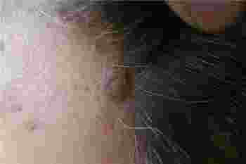 _脸上的痣去掉会不会影响命运_面相不好的痣点掉就会好吗-第3张-民俗文化-玉仓库