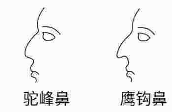 为什么有的人要破相才好_为什么说女孩额头破相命好