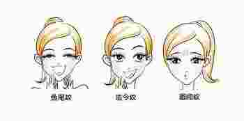 眉间八字纹怎么消除_八字纹怎么消除