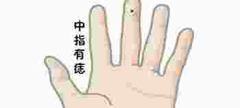右手中指长有痣的女人好不好_女人右手中指上长的痣代表什么
