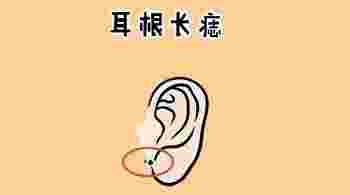 男人耳朵上有痣图解对照表_男人耳朵痣的位置与命运图