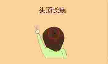 头顶长痣命运图解_头顶长痣命运如何