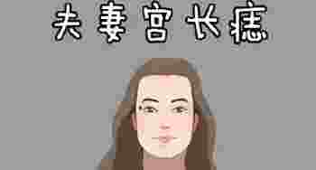 夫妻宫有痣的女人好不好_夫妻宫有痣的女人可以去掉吗