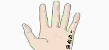 右手小拇指上长有痣代表什么_小拇指上长痣代表什么