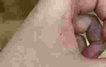 虎口有痣的女人_手背虎口有痣的女人