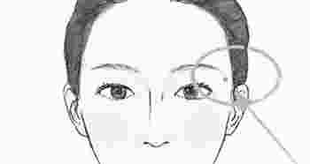 迁移宫有痣的图片_面相迁移宫有痣
