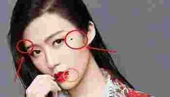 天生富婆命的痣_女人大富婆很有钱的痣