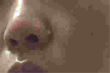 _脸上的痣去掉会不会影响命运_面相不好的痣点掉就会好吗-第4张-民俗文化-玉仓库