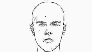 男人脸上的痣哪些不能去掉图片_男人脸上的痣