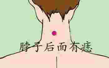脖子有痣的男人好不好_脖子有痣的男人怎么样